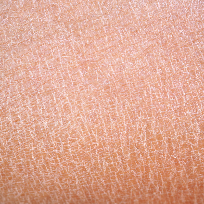 What causes dry skin?