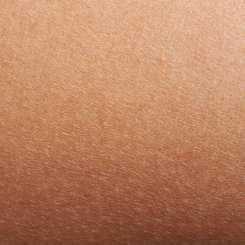 What causes dull skin?