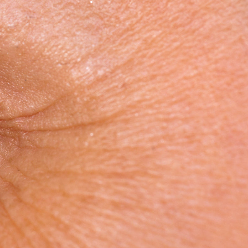 What causes fine lines?